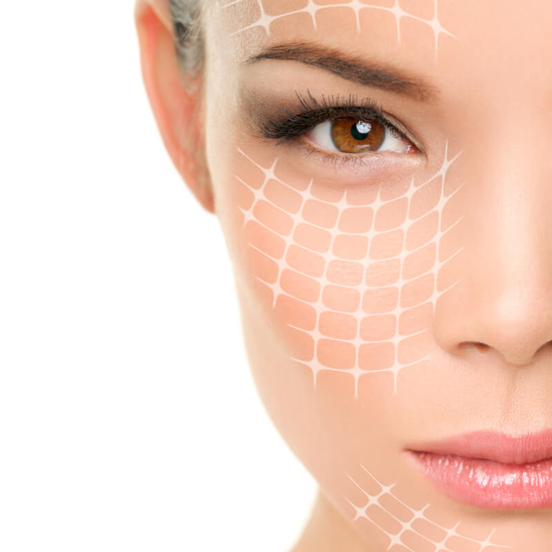 Behandlungen mit Radiesse®